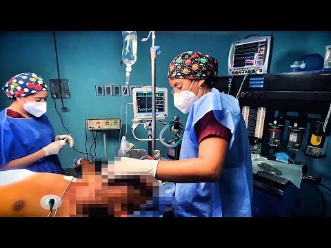 Un Día en Anestesiología - Videolaringoscopia | Mentes Médicas