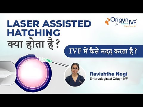 What is Laser Assisted Hatching? | Boost IVF Success with This Simple Laser Technique! | Origyn IVF