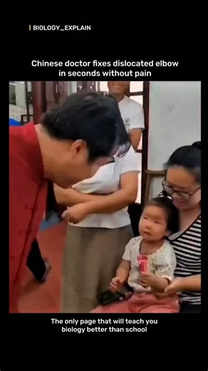 medical / biology explain on Instagram: "A skilled Chinese doctor quickly resets a dislocated elbow using a traditional manual technique that realigns the joint in seconds. This method is effective, causes minimal discomfort, and shows the precision and expertise of trained practitioners in joint manipulation. #doctor #facts #knowledge #didyouknow #reels #viral #fyp#medical #educational"
