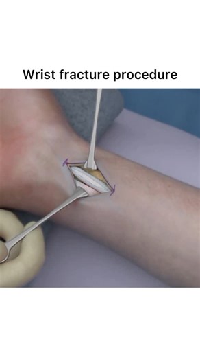 Animations | Follow @surgicalanimation for more! 🏥 | Instagram