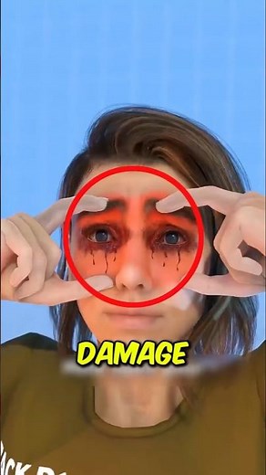 Sleeping With Contacts Is Worse Than You Think 😳