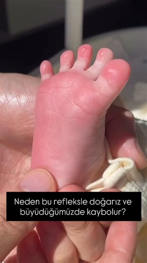 HEMSİREYİZBİZ | Babinski refleksi (Babinski belirtisi), merkezi sinir sisteminin özellikle piramidal yol (kortikospinal traktus) bütünlüğünü... | Instagram