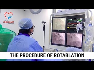 Rotablation Procedure - Dr. Ankur Phatarpekar & Team