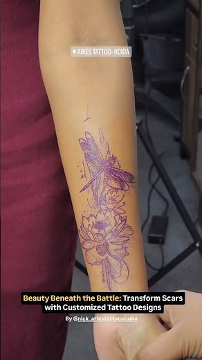 Scar Cover-Up Tattoo | Transforming Scars into Art
