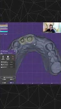 exocad Training Session - Seth Potter