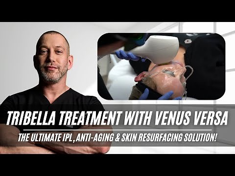 Tribella Treatment with Venus Versa | IPL, Anti-Aging and Skin Resurfacing