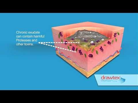 Drawtex Hydroconductive Wound Dressing