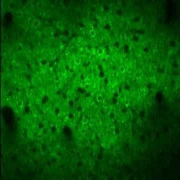 Neurons firing in the auditory cortex of the brain