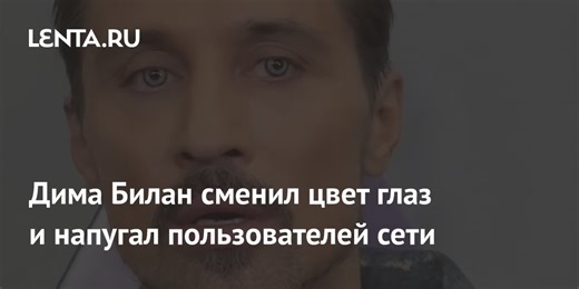 Дима Билан сменил цвет глаз и напугал пользователей сети