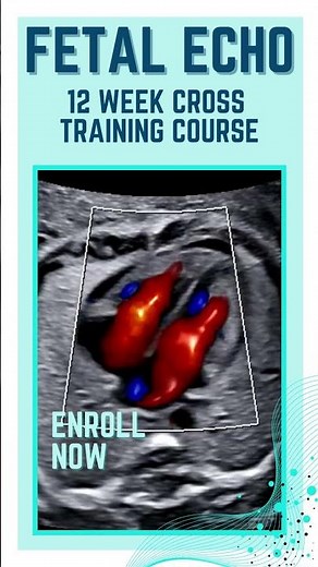 Fetal Echo Cross Training