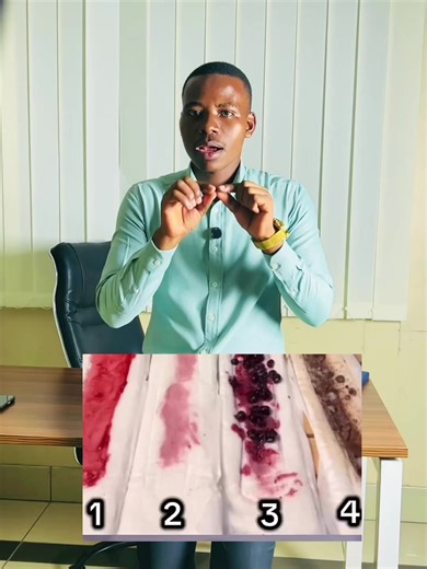 Aina za damu ya hedhi na maana yake kwa mwanamke