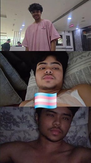 “FTM Chest Surgery | Healing to Results” 🏳️‍⚧️ #ftm