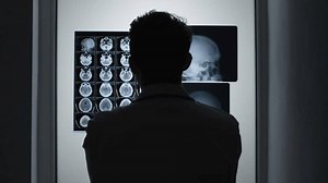 Doctor Reviews X-ray Images Diagnosis Stock Footage Video (100% Royalty-free) 3786930767 | Shutterstock