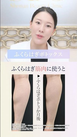 [Leg Slimming] Muscular legs can be slimmed down with Botox [Beautiful Leg Diet] Reika Nishikawa,...