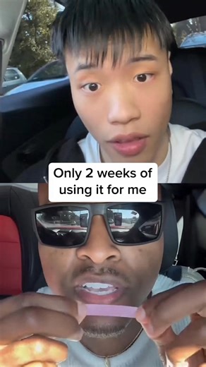 1.4K views | Yellow tones? Canceled. SNOW’s Purple Whitening Strips are the fast fix your smile needs.  Color-corrects surface stains instantly ⏱️ Quick, easy & mess-free — just apply and glow ✅ Gentle on enamel, strong on brightness ⚡️ See a visible difference after just one use No harsh bleach, no waiting weeks. Just peel, apply, and slay your smile #deepcleaning #teethtok #trending #oralhygiene #whiteningstrips | SNOW Teeth Whitening | Facebook