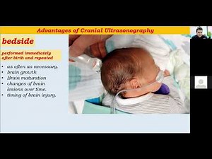 part 1 :: Road map for cranial ultrasound training .. Dr.Mohamed Soliman