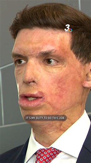 Retired army captain Sam Brown is a war hero, left with battle scars from a roadside bomb that blew up under his vehicle during a rescue mission in Afghanistan in 2008. The Purple Heart recipient moved from Texas to Nevada in 2018 and lives in Reno with his wife and three children. We caught up with him at former president Donald Trump's Las Vegas rally in mid-September. MORE: News3LV.com | KSNV News 3, Las Vegas