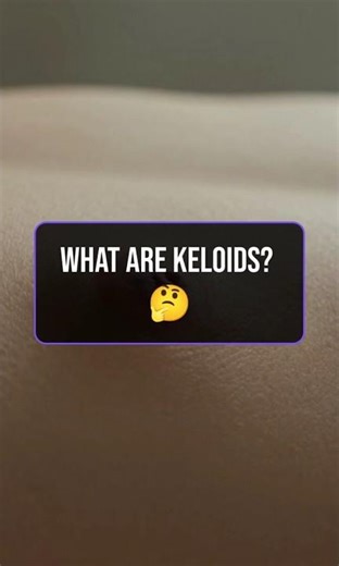 What Are Keloids? 🤔 #health #facts #shorts