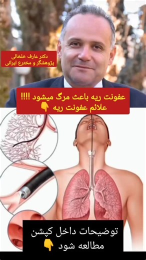 ‎دکترعارف‌خلخالی‌ مخترع پودرگیاهی سوپرفود NBS‎ | ‎یکی از خطرناک‌ترین عفونت‌ها در بدن، در ریه رخ می‌دهد و می‌تواند به عاملی بسیار خطرناک تبدیل شده و باعث مـــــرگ انسان شود. به همین دلیل...‎ | Instagram