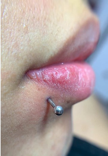 Understanding Labret Lateral Piercings