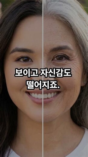 기미! 레이저토닝으로 극복하는 방법 공개!