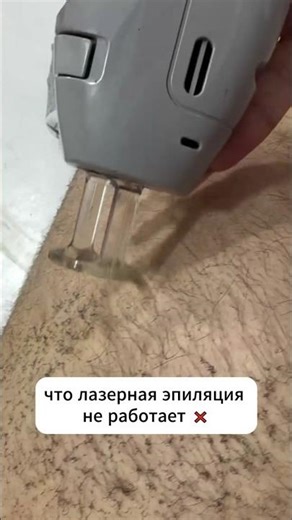 Почему не работает лазерная эпиляция? Читай описание 👇