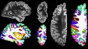Seven Tesla MRI generates high-resolution dataset of ex vivo brain tissue specimen and successfully segments cortical regions