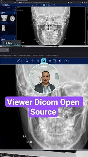 Viewer Dicom Open Source #medical #healthylifestyle #radiología