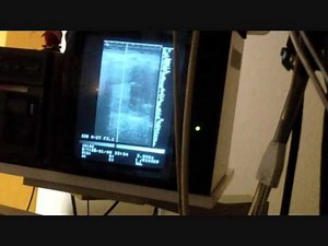 new (female) ultrasound exam