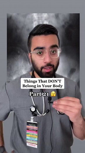 Buzz Lightyear X-Ray: Things That Don't Belong in Your Body