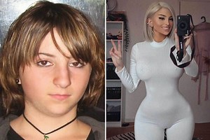 I spent £20k on plastic surgery to get a man but I’ve been single for 7 years