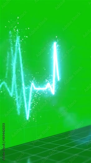 Green Screen 3d render of a heartbeat frequency on cardiograph recording pulse scene 4 with distortion, overlay, glitch, static noise, scan lines black background, 4k animated video loop
