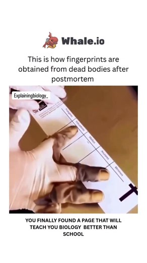 BIOLOGY | MEDICAL | HEALTH on Instagram: "Fingerprint Extraction After Postmortem In forensic science, fingerprints are one of the most reliable methods for identifying a deceased individual. Even after death, the unique ridges on the fingertips remain intact and can be recovered for investigation. When the skin is damaged or dehydrated,forensic experts use techniques such as rehydration, chemical treatment, or even removing the outer skin to access the ridge patterns. These methods help restore