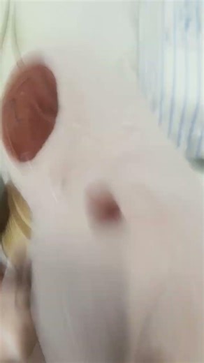 tui bị khùng