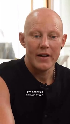 Heather Fisher opens up on her experience with alopecia and the belief that she “was born to stand out”. #grrrl #grrrlarmy | GRRRL Clothing