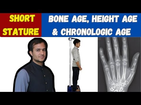 Bone age , height age, and chronological age - Short stature - Age estimation