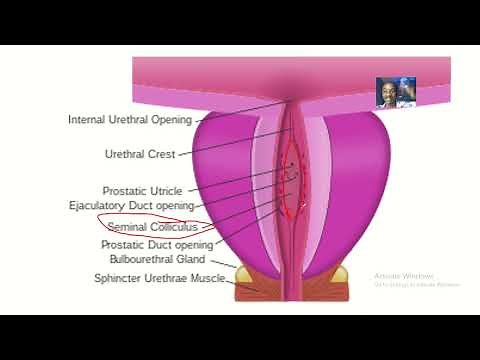 The verumontanum or Seminal colliculus; its anatomy, location, contents and clinical knowledge