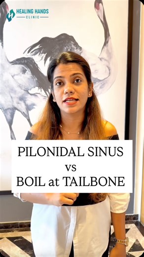 Healing Hands Clinic | Piles, Fissure, Fistula on Instagram: "A boil is a one-time skin infection that usually heals with antibiotics or drainage. A Pilonidal Sinus, on the other hand, is a tunnel under the skin that keeps collecting hair and debris. Here’s how to tell the difference: 👉🏽Boil: sudden swelling, painful, usually one-off 👉🏽Pilonidal Sinus: keeps coming back, discharges pus or blood, may have a small opening or “pit” in the skin. 🛑 Boils may he