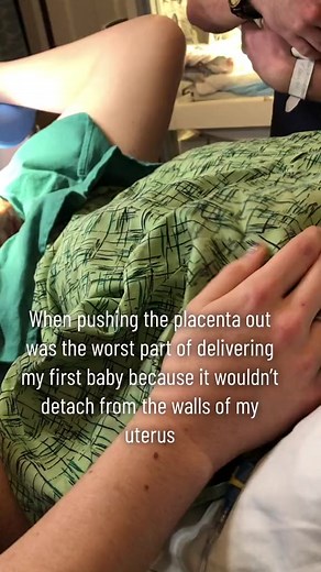 Definitely wasn’t expecting that amount of pain after a painless delivery with my baby🤱🏼 #delivery #birth #laboranddelivery #placenta | Labor and delivery