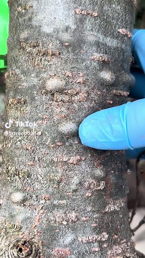 Satisfying Tree Popper Hand Pimple Pop ASMR Sounds