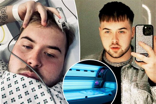 Tanning addict given nightmare diagnosis after hitting beds up to five times a week