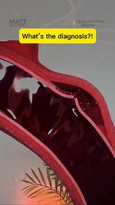 Study Cardiology Smarter with Dr. Matt Barrett's Study Guide