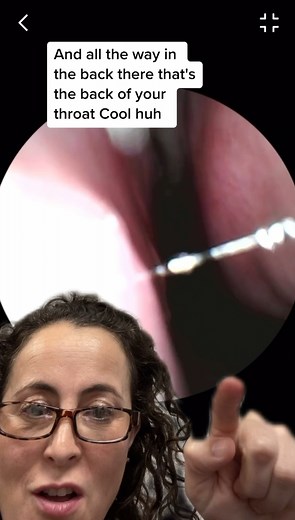 5.8K views · 59 reactions | A tour of the inside of your nose! Turbinates are normal anatomy. They help cool and warm and filter the air we breathe. #medicalknowledge #nasalturbinate #entdoctor #allergylife | Teach Me Doc | Facebook