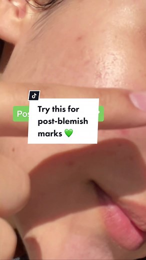 Unlock Clear Skin: Paula's Choice Azelaic Acid Skincare Booster