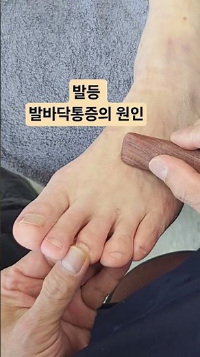 발등 발바닥통증의 원인