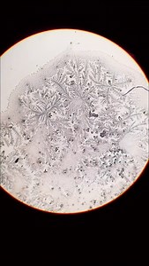 Exploring Human Tears Under a Microscope