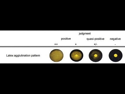 Latex Agglutination Test - Amrita University