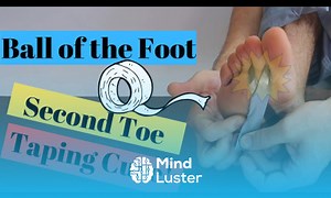 Mind Luster - Learn 2nd Toe Pain Capsulitis Ball of Foot Taping 2022 Home Treatment