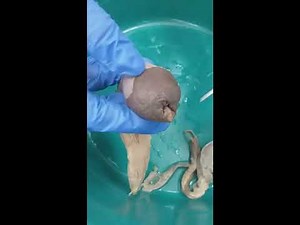 Male External Genitalia