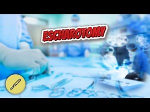 Escharotomy - Everything Surgeries ✅😬⁉️